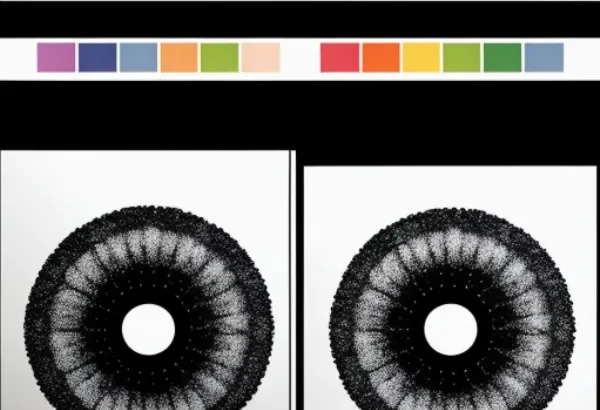 In thương và in UV